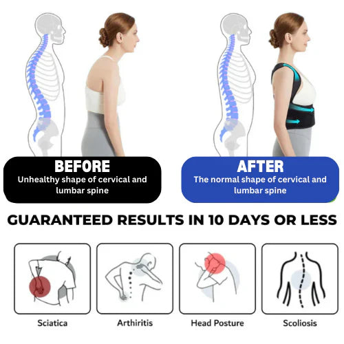 Everglowly™ Adjustable Posture Corrector